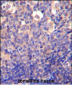 KLRC2 Antibody (N-term)